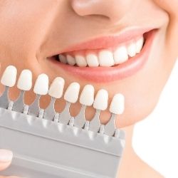 Toronto Dental Porcelain Veneers